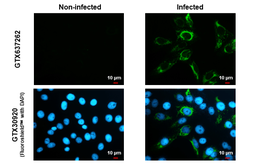 Anti-Zika virus NS4B protein antibody [HL1664] used in Immunocytochemistry/ Immunofluorescence (ICC/IF). GTX637262